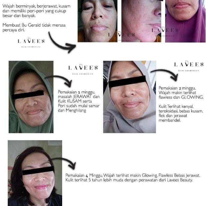 whitening night cream + lavees + krem flek PROMO 3489