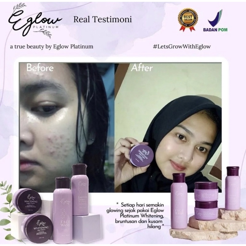 E GLOW PLATINUM SKINCARE | PAKET WAJAH WHITENING ACNE ULTIMATE | PENCERAH PEMUTIH PENGHILANG FLEK NODA HITAM JERAWAT BEKAS JERAWAT PADA WAJAH VIRAL AMAN BPOM