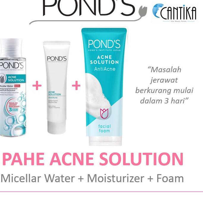ponds acne solution