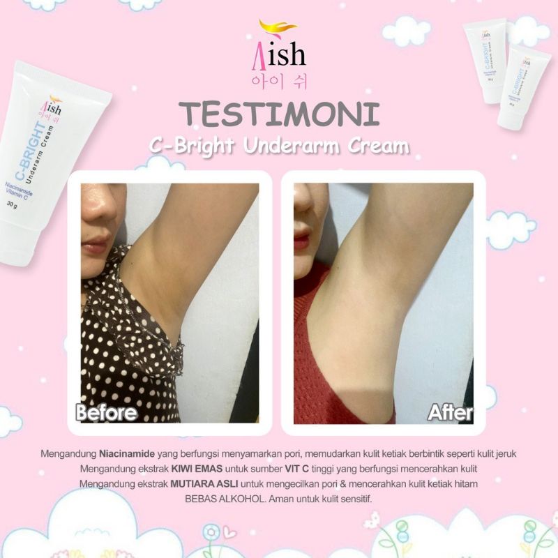 Aish C Bright Underarm Cream Pencerahkan Kulit Ketiak