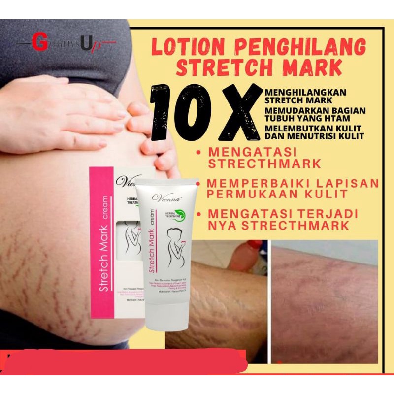 [rumahbayipdg] Vienna cream ORIGINAL penghilang Stretch Mark/Garis perut /selulit