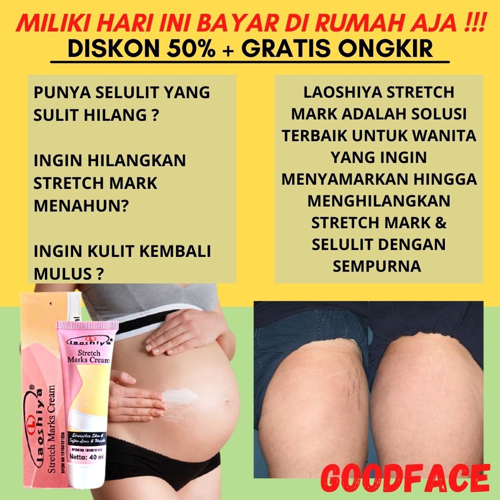 LAOSHIYA STRETCH MARKS CREAM ORIGINAL BPOM STRETCH MARKS LAOSHIYA PENGHILANG STRECT MARK