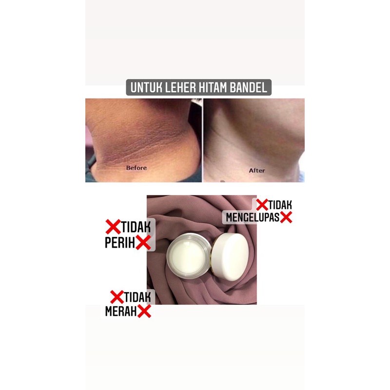CREAM PEMUTIH LEHER AMPUH ~ ANTI WAJAH PUTIH LEHER HITAM / NECK CREAM [ CREAM LEHER ]