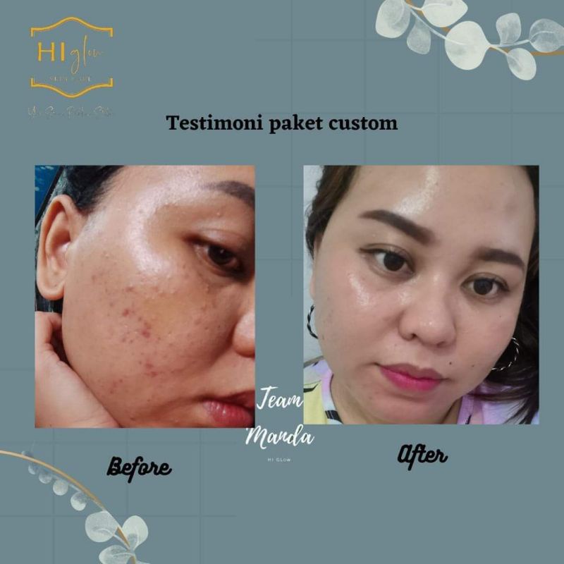 ECER Custom Hi Glow Skincare (AS+,AC1+,AC2+,AC3+,AC4+,W1+,W2+,W3+,W4+,N1+,F1+)