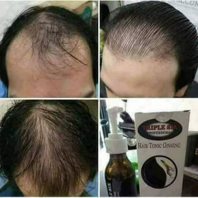 TRIPLE SIX HAIR TONIC GINSENG NASA