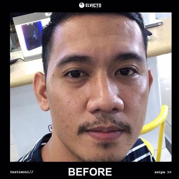 Terbaru Elvicto Brightening Serum / Serum Wajah Pria/ Serum Elvicto /