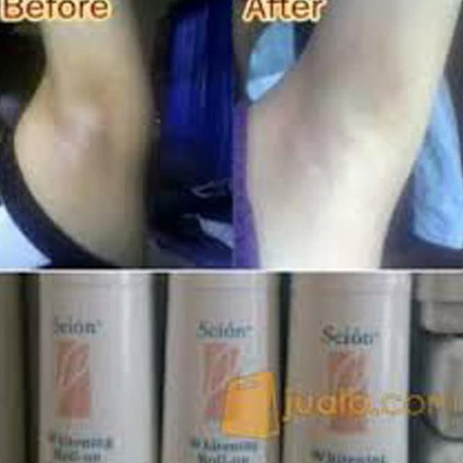 FJKX PEMUTIH KETIAK / PENCERAH KETIAK / PENGHARUM KETIAK / PELEMBUT KETIAK YAVW