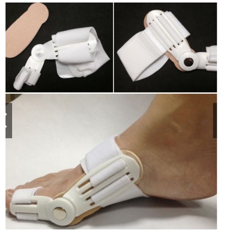 ALAT TERAPI JEMPOL KAKI BUNION PAD PELURUS JEMPOL KAKI, HALLUX VALGUS SPLINT