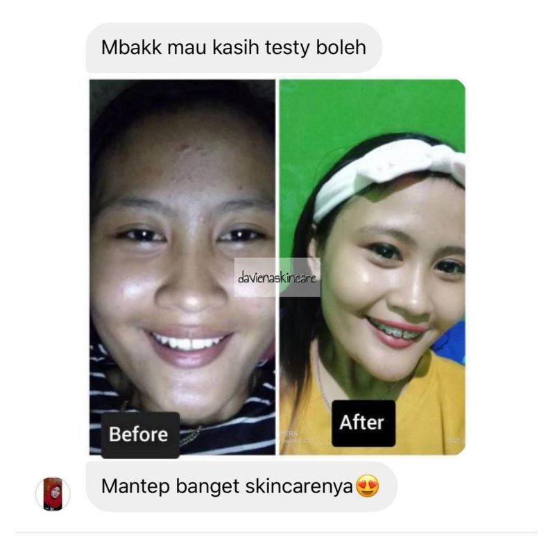 GOLD SERIES DAVIENA SKINCARE//PAKET FLEK/MELASMA-5