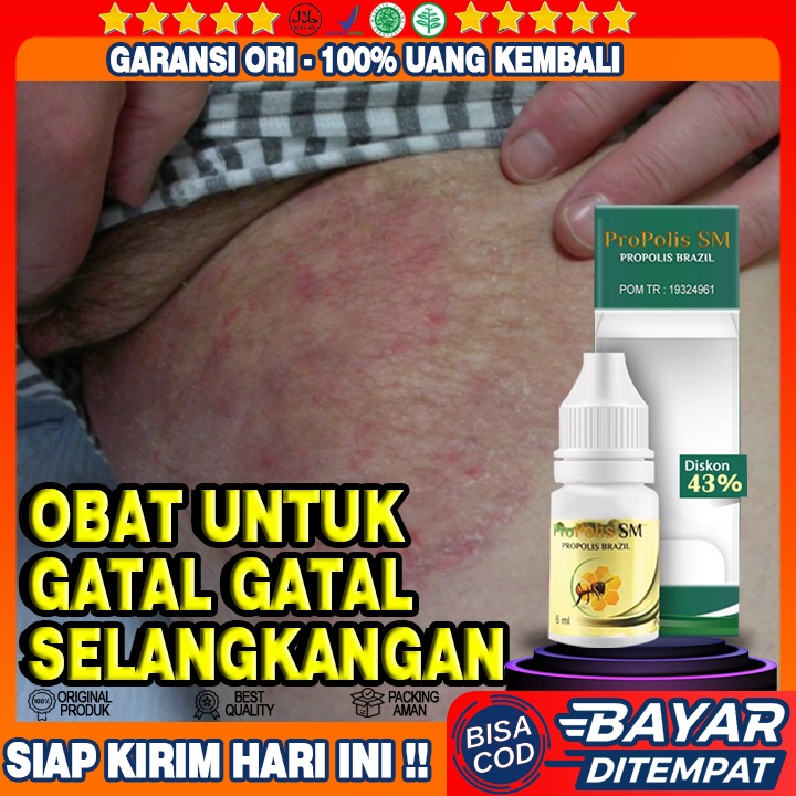 Obat Gatal Selangkangan, Obat Selangkangan Hitam, Obat Selangkangan Gatal, Obat Jamur Selangkangan
