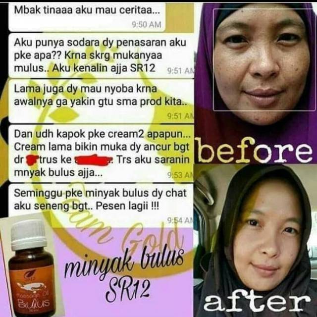 Super Minyak Bulus Sr12 Asli Bpom Solusi Jerawat Flek Hitam Dan Stretchmark Pembesar Payudara Shopee Indonesia