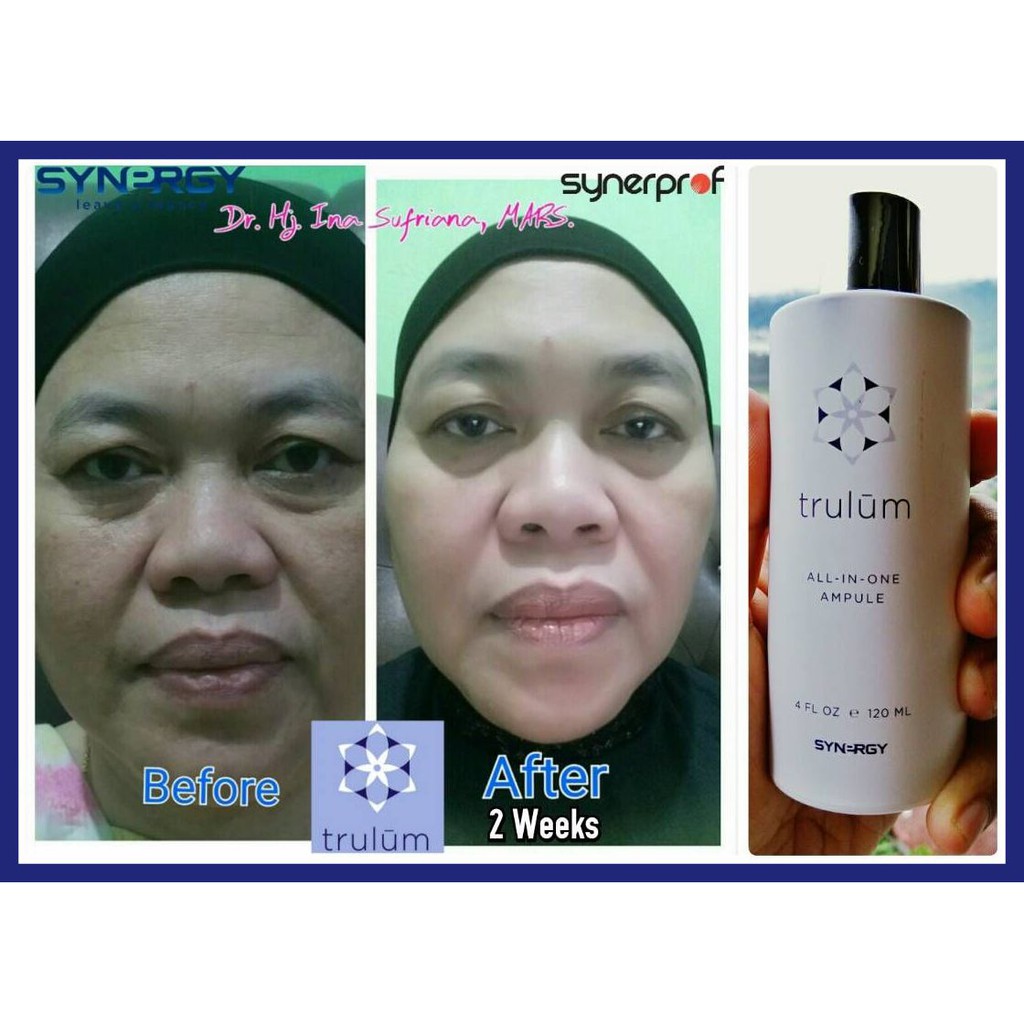Hilangkan Keriput Di Wajah | Trulum Pengganti Masker Cream/krim Wajah