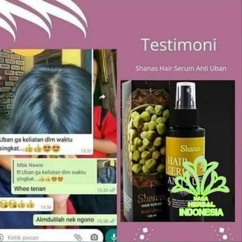 COD FREE ONGKIR Terlaris Serum Penghilang Uban Shampo Anti uban shanas ampuh