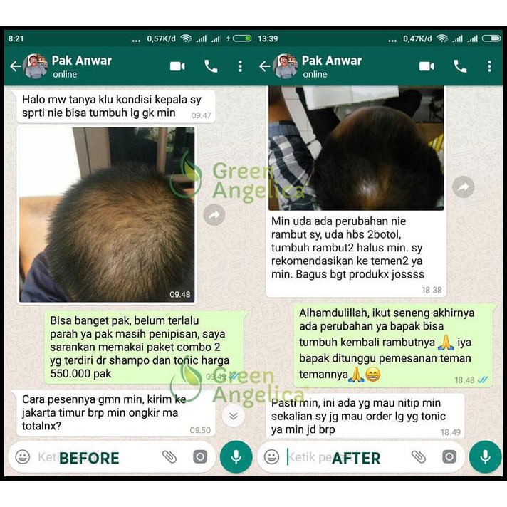 Promo | Perawatan Rambut Paling Lengkap Green Angelica Paket Maximal Treatment