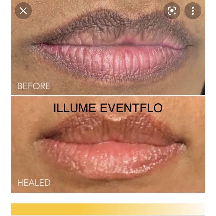 PermaBlend Evenflo ILUME / KOREKSI  Bibir BEST SELLER USA