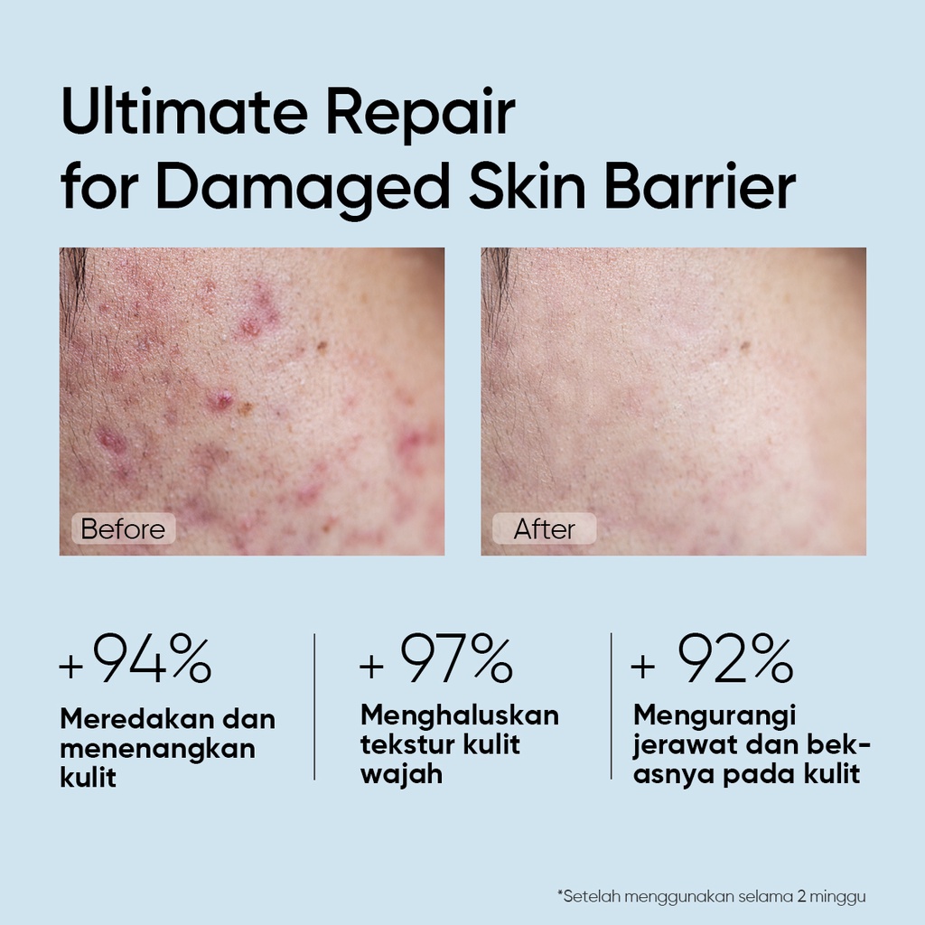 [BPOM] SKINTIFIC 5X Ceramide Barrier improve Serum 20ml Alpha Arbutin Ceramide Pemutih