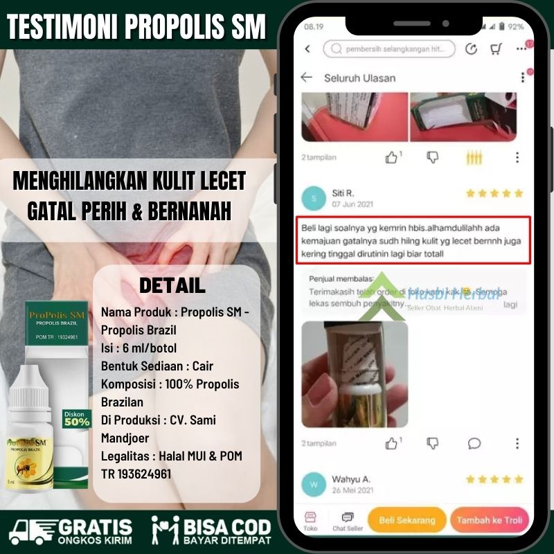 Salep Penghilang Selangkangan Hitam Akibat Jamur - Penghilang Gatel - Penghilang Bekas Kulit Lecet - Propolis SM 100% Original Alami-4