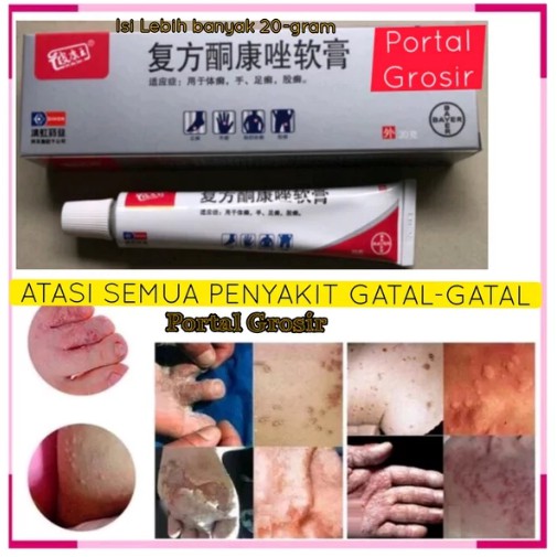 SALEP jumbo 20gram PI KANG WANG Original  KL BL PKW asli - Obat gatal Kulit exsims Eksim s Menahun
