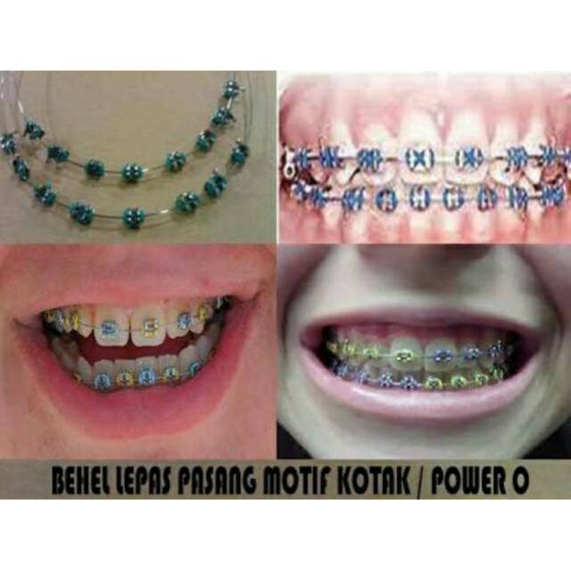 Paket Behel Fashion Lepas Pasang Sepasang Dapat Atas Dan Bawah Indonesia