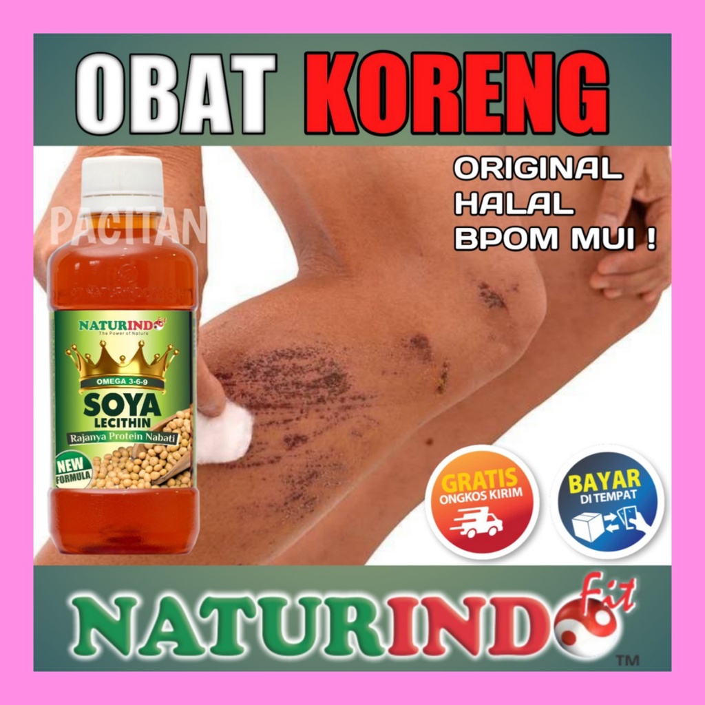 OBAT KORENG KULIT MENGHITAM PENGHILANG BEKAS LUKA KORENGAN GATAL BOPENG PALING AMPUH NATURINDO COD