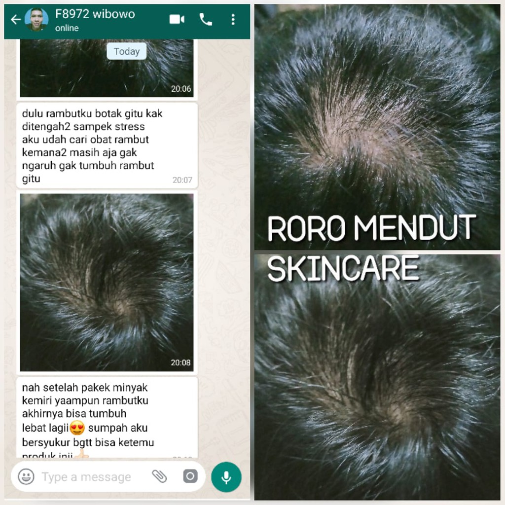 Minyak Kemiri ASLI Roro Mendut Penumbuh Penebal Rambut Bayi Dewasa Botak Rontok Brewok Kumis Jambang