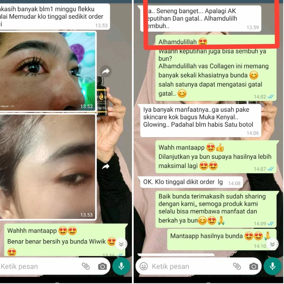 {JGO.25Au22ᴹ} VAS COLLAGEN PEMUTIH KULIT / Collagen Drink BPOM AMAN BUSUI BUMIL