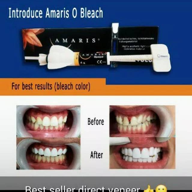 Composite Amaris o bleach O Bleach Veneer German