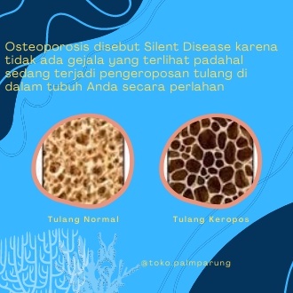 Marine Organic Calcium Mineral Alami Mencegah Osteoporosis Dan Membentuk Tulang Anda Lebih Padat