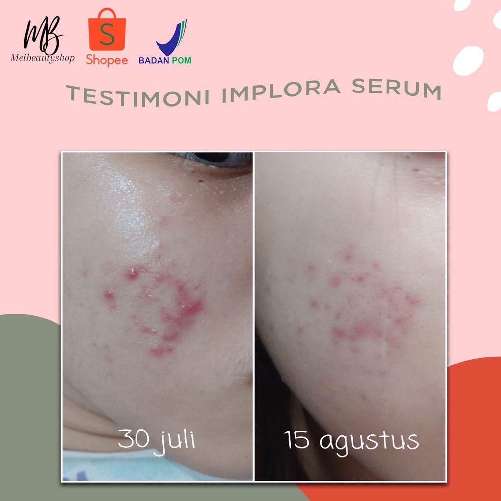 IMPLORA Serum Wajah 20 ML