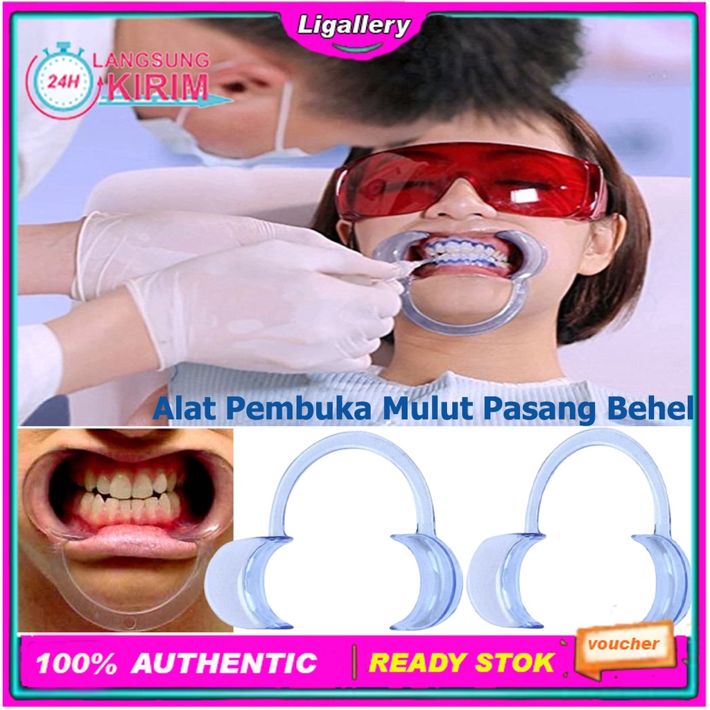 [BISA COD] 1 Pcs Alat Pembuka Mulut Untuk Pemasangan Behel Alat Pembuka Penyangga Mulut Mouthgate El