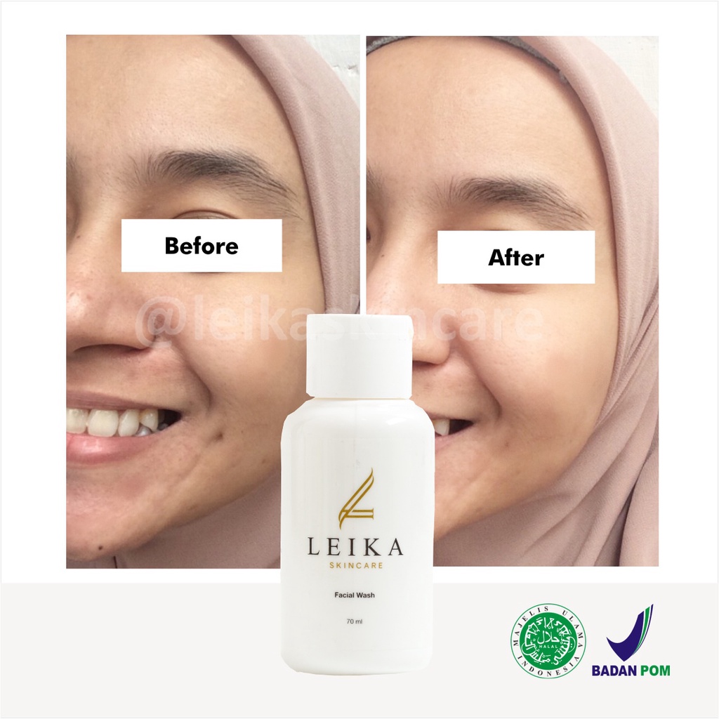 Ampuh! Toner Pembersih Kulit Wajah Pelembab Kulit Wajah Anti Aging Penyembuhan Luka Jerawat Pengangkat Sel Kulit Mati Penghalus Kulit Wajah Pembersih Pori-pori Wajah Pereda Peradangan Akibat Jerawat Toner Leika Skincare