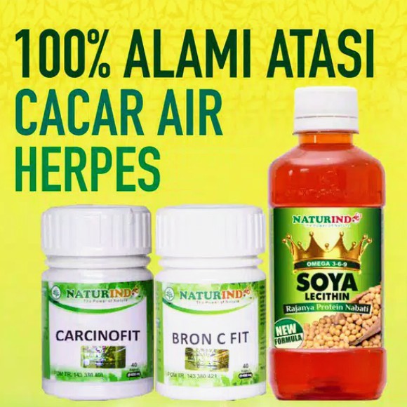 

100% Alami Atasi Cacar Air Herpes