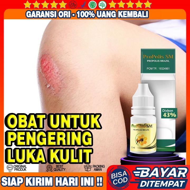 Obat Pengering Luka, Luka Bakar, Luka Berdarah, Luka Melepuh, Luka Bernanah, Luka Lecet, Luka Diabet