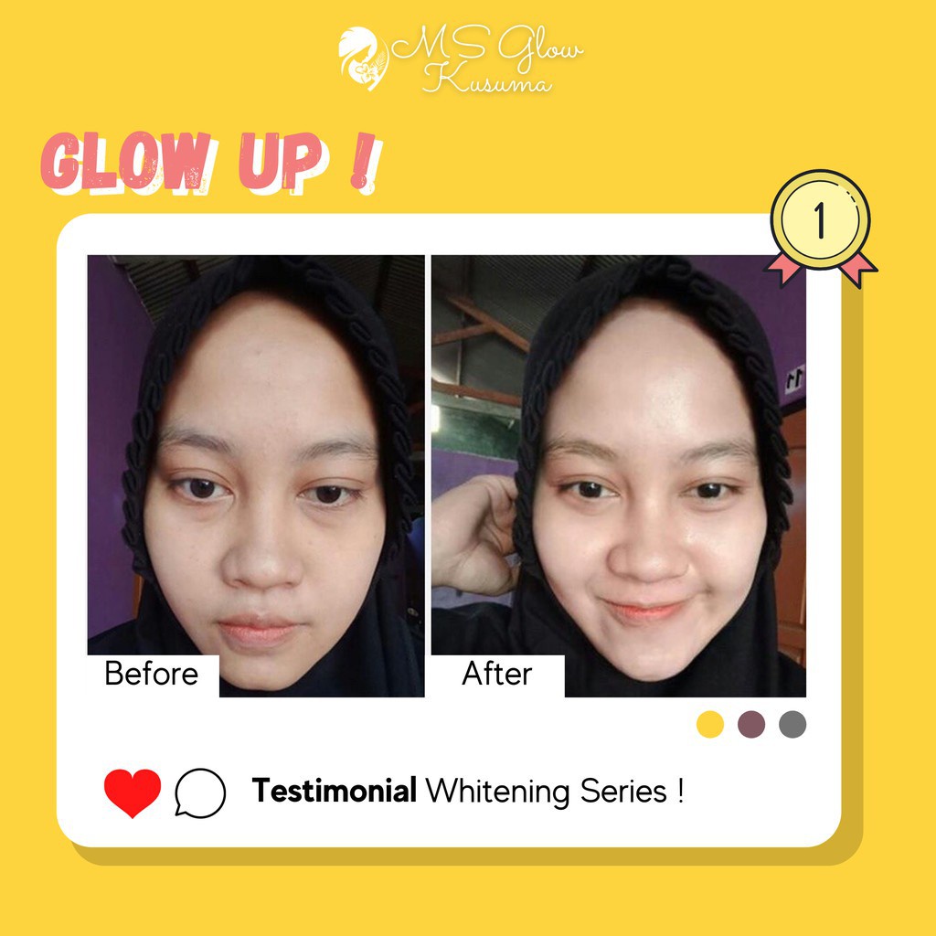 MS Glow Paket Wajah Whitening Acne Ultimate Luminous Komplit Dengan Facial Wash Toner Day Cream BB Cream Night Cream Serum Whitening Gold Lifting Acne Luminous Peeling Cell DNA Red Jelly Deep Essence Yuzu Cactus Watermelon Moisturizing