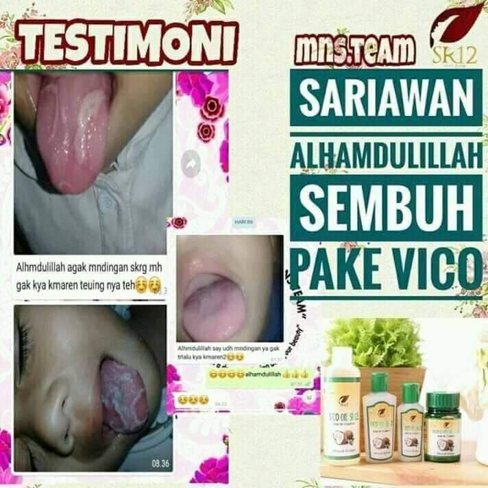 VCO Oil SR12 Obat Sariawan - Obat Sakit Gigi dan Bau Mulut