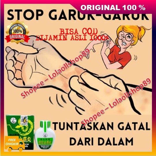 Ramuan Cina Snake Itch Biduran Eksim Ampuh 100% ASLI ORIGINAL