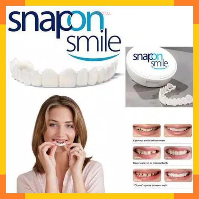 Snap on Smile Veneers Gigi Perfect Smile Gigi Tiruan Gigi Palsu