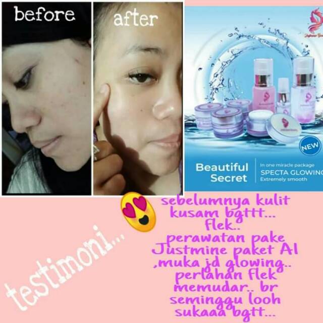 cream justmine remove spot