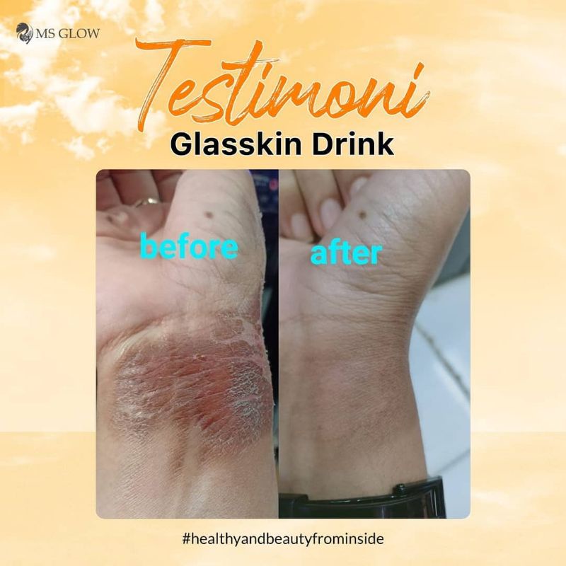 GLASSKIN DRINK MSGLOW MINUMAN COLLAGEN PEMUTIH BADAN