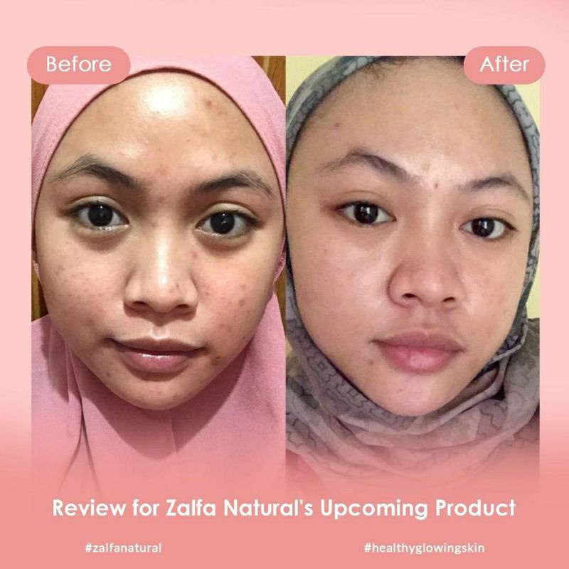 Zalfa Natural Skincare Skincare Probio Herbs Bakuchiol Peptide Acne Ampoule-4
