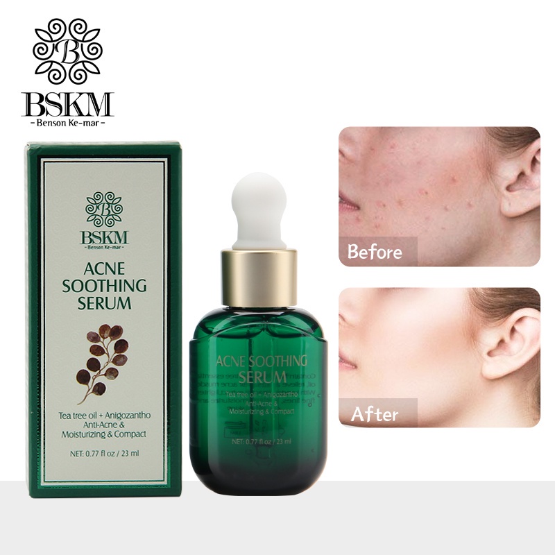 BSKM Tea Tree Oil Acne Treatment Serum Repair Moisturizing- Perawatan &amp; Penghilang Jerawat Wajah 23ml