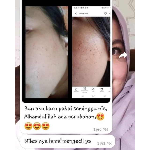 Noni beauty skincare