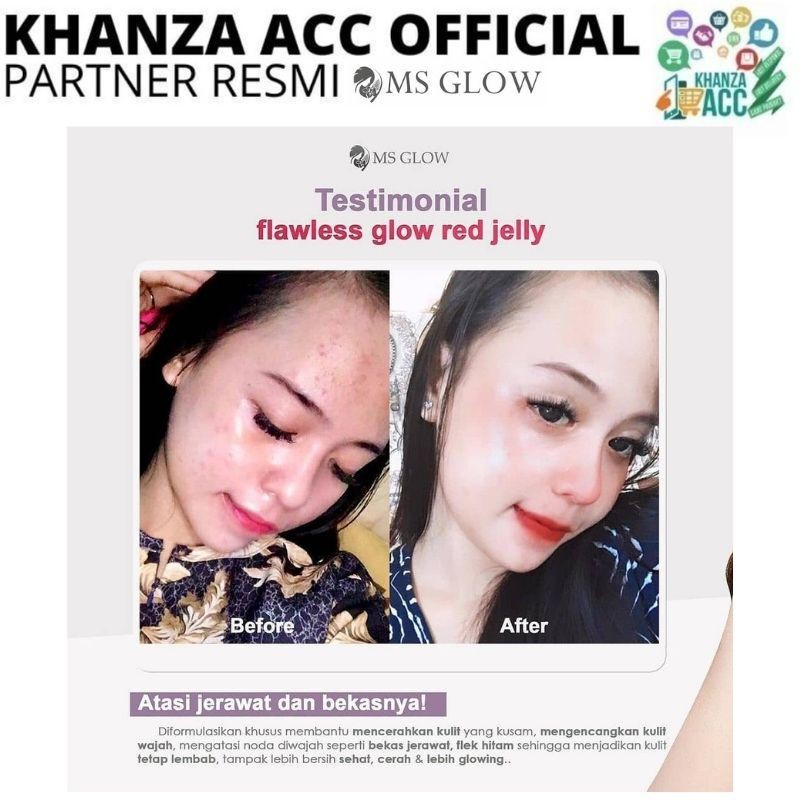 KHANZAACC MS GLOW Flawless Glow Red Jelly Extra Glowing Original