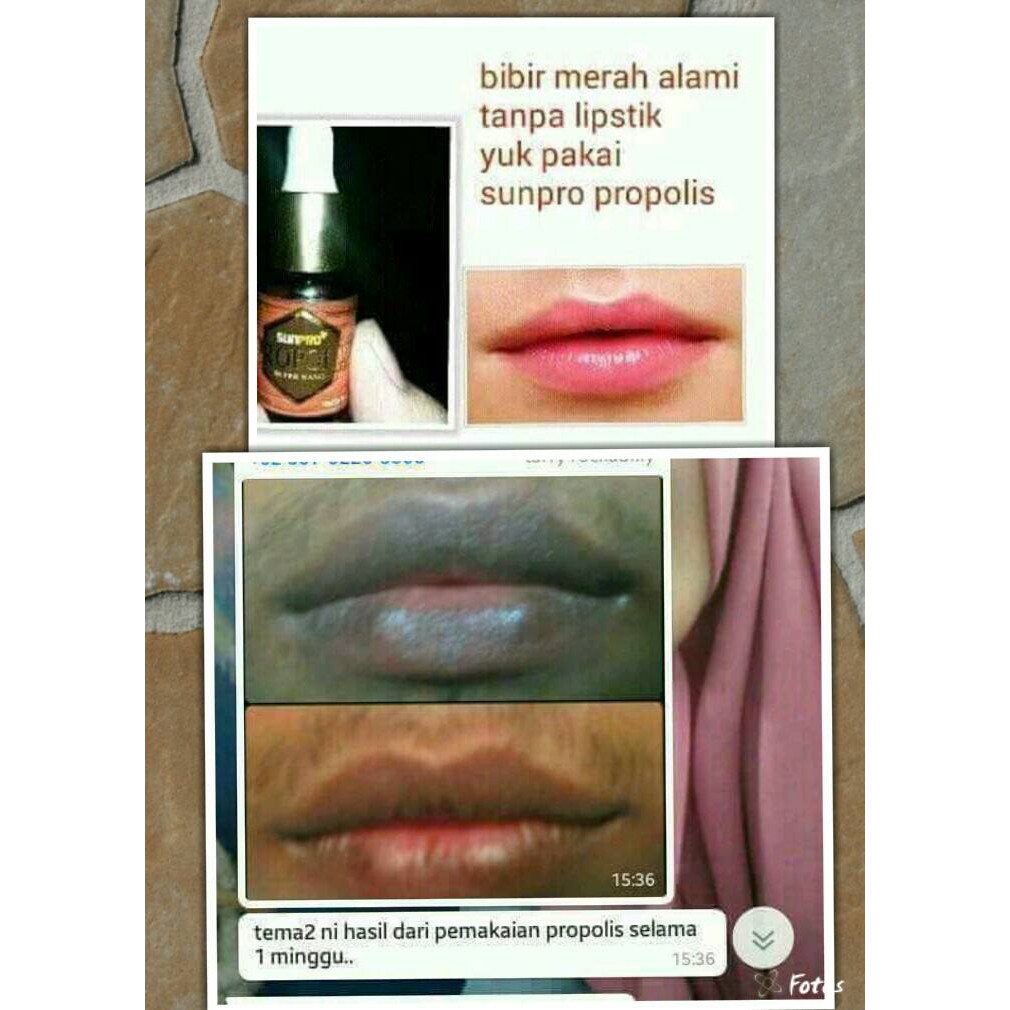 20 Cara Memerahkan Bibir Yang Hitam Secara Alami Dan Cepat