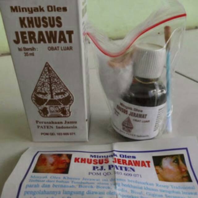 MINYAK OLES OBAT JERAWAT CAP WAYANG ORIGINAL - OBAT JERAWAT PALING AMPUH