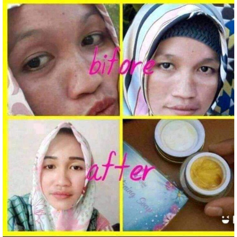 paket glowing gold jelly dan brithening shop KEDAS beauty ORI 100% geratis gift cermin dan gantungan kunci-3
