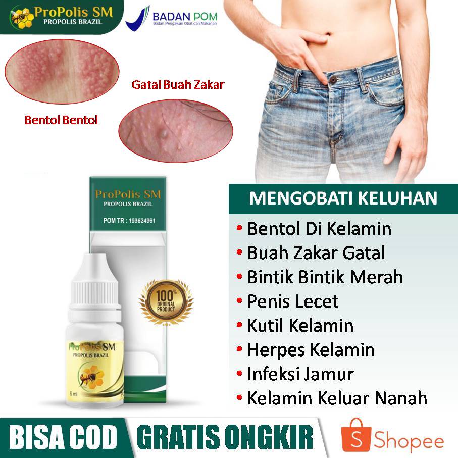 Obat Bentol Di Kelamin, Buah Zakar Gatal, Penis Lecet, Bintik Bintik Merah, Benjolan Kelamin, Herpes