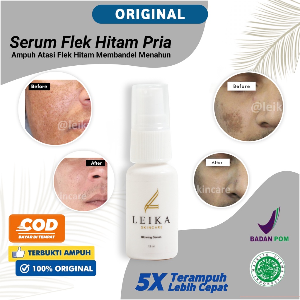 Penghilang Flek Melasma Serum Flek Hitam Ampuh BPOM Serum Penghilang Flek Membandel Menahun Serum Me