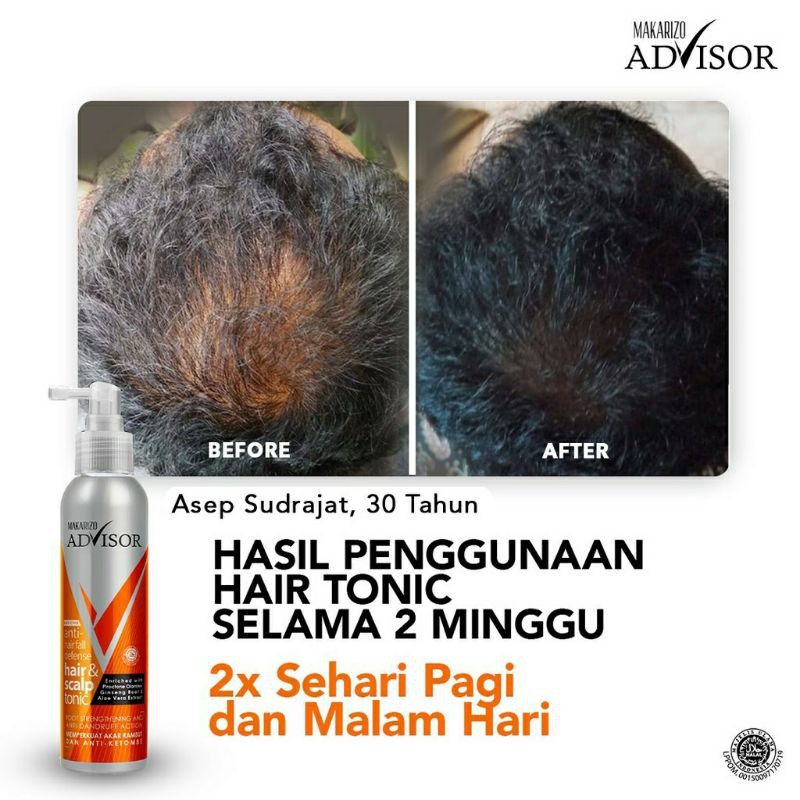 Makarizo Advisor Hair &amp; Scalp Tonic 145mL / Perawatan Rambut Rontok dan Ketombe / Anti Hair Fall