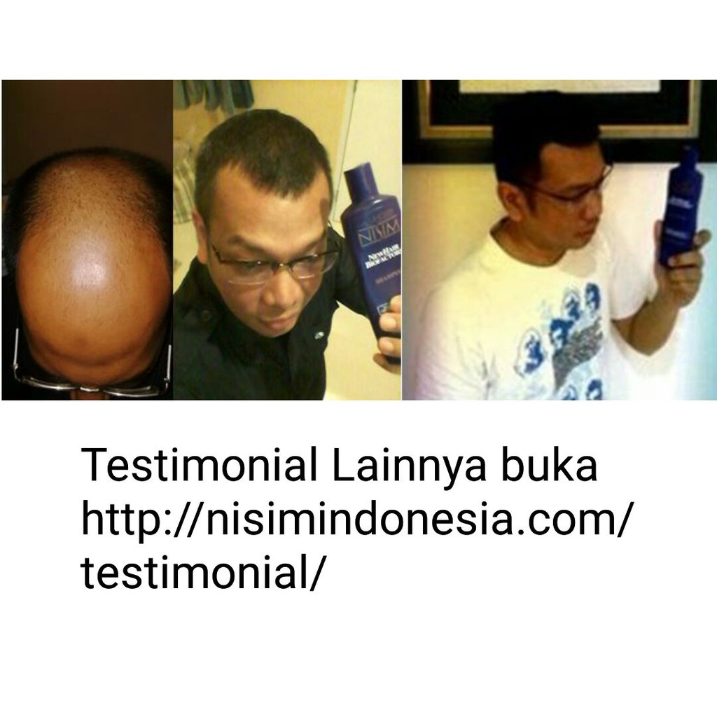 Hairtonic Nisim Biofactors Normal Minyak